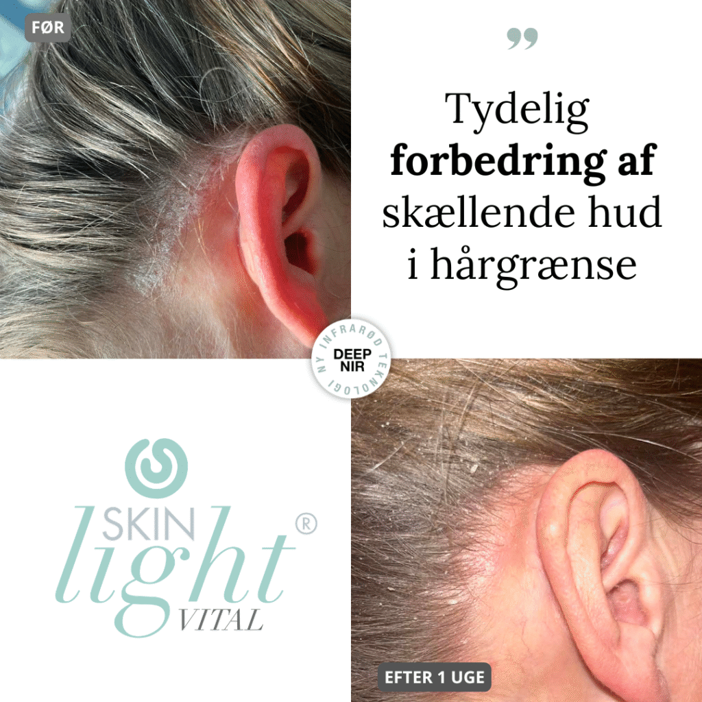 SKINlight HAIR hårserum 100 ml - Billede 5
