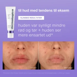 Alternative view of stabilizing repair serum 50 ml